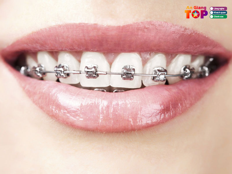 phong-kham-rang-ham-mat-bs-thuy-tien-angiangtoplist