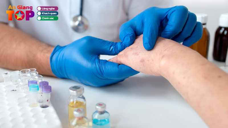 Top-6-phong-kham-bac-si-da-lieu-an-giang-noi-tieng-tan-tam-angiangtoplist