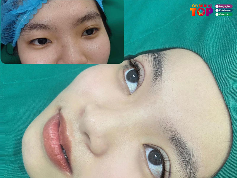 Tham-my-vien-thao-mai-angiangtoplist