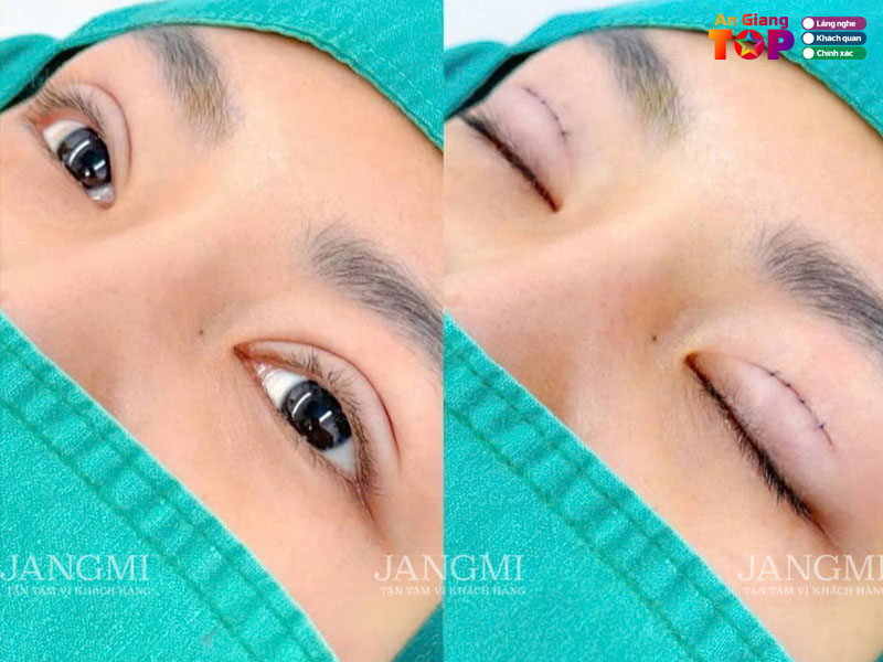 Vien-tham-my-jangmi-angiangtoplist