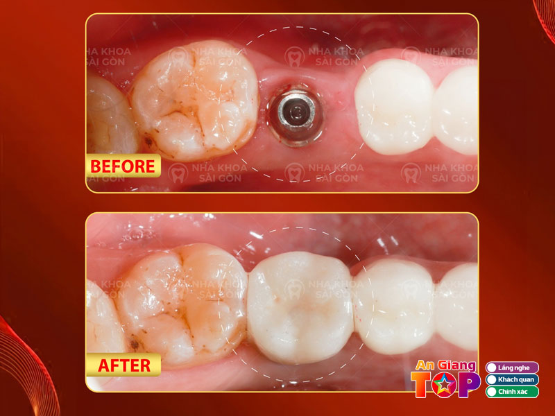 Nha-khoa-sai-gon-angiangtoplist