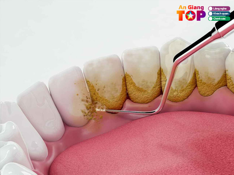 Nha-khoa-long-xuyen-angiangtoplist