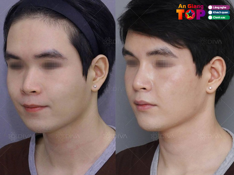 Vien-tham-my-diva-angiangtoplist