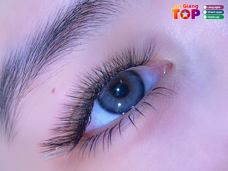 Noi-mi-oc-tieu-angiangtoplist