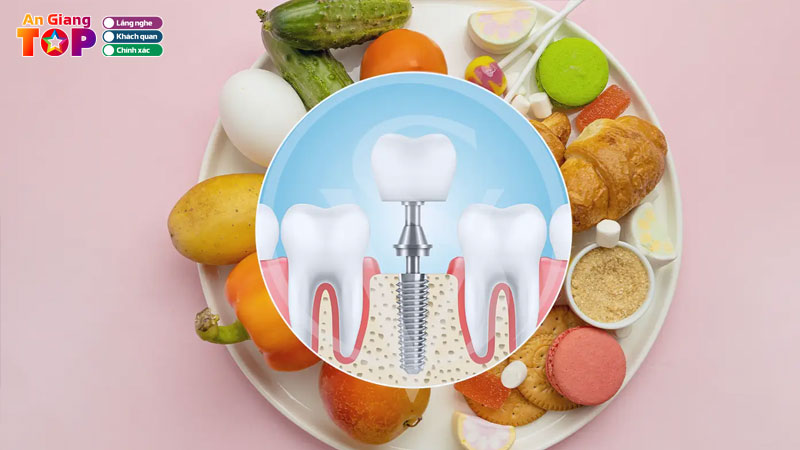 Nguoi-trong-rang-implant-co-nen-an-chay-khong-angiangtoplist