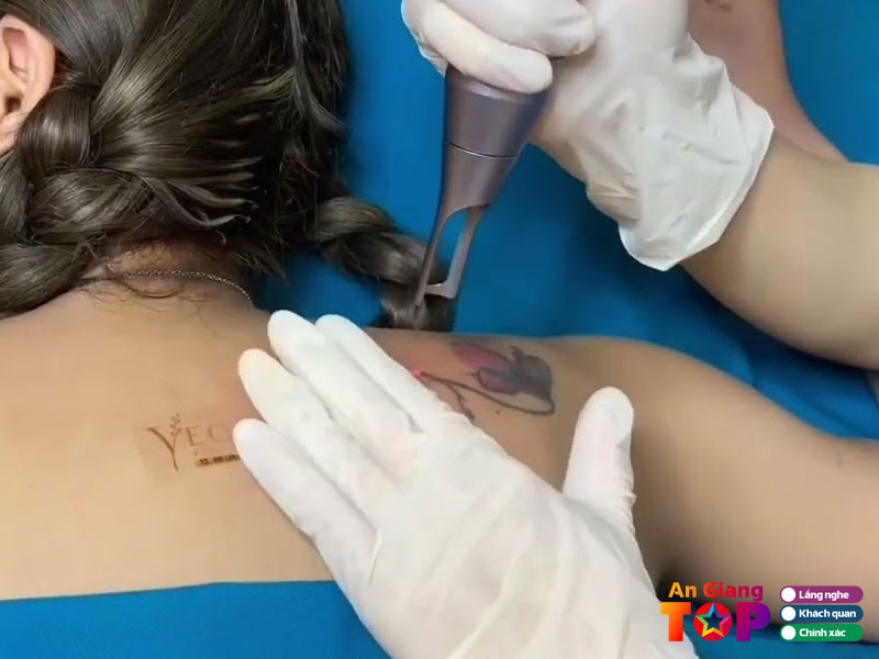 Duyen-beauty-spa-angiangtoplist