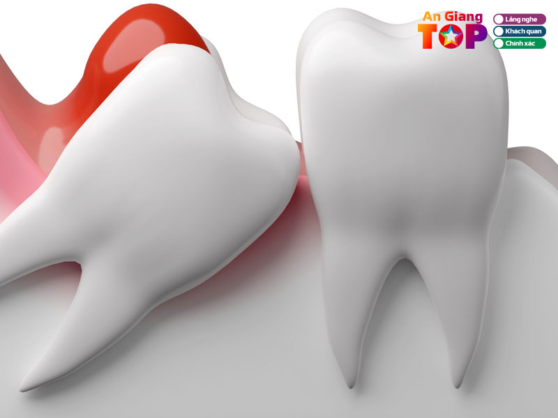 Nha-khoa-quoc-te-lava-angiangtoplist