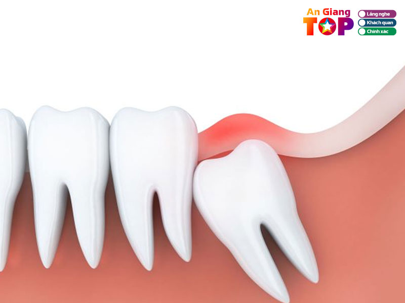 Nha-khoa-viet-my-angiangtoplist