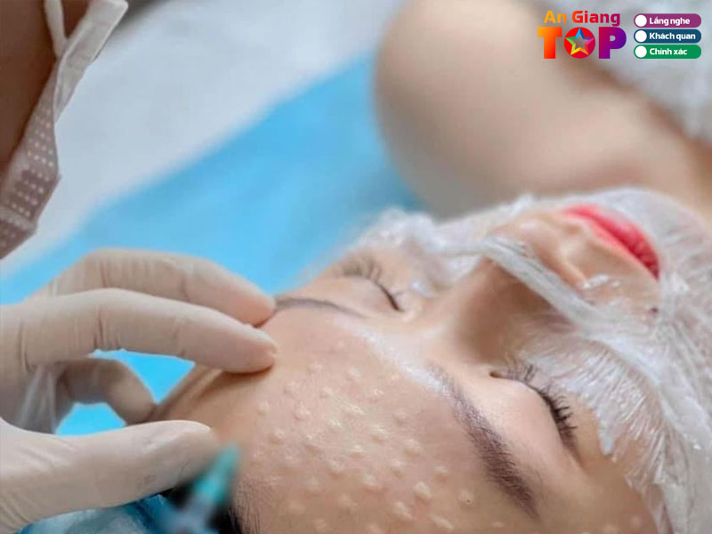 Tieu-chi-chon-dia-chi-tiem-meso-an-toan-angiangtoplist