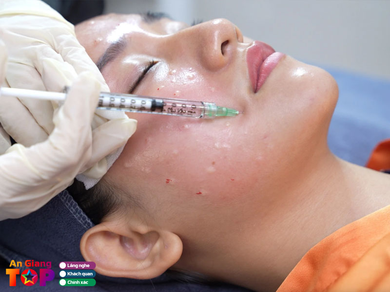 Vien-tham-my-quoc-te-au-han-angiangtoplist