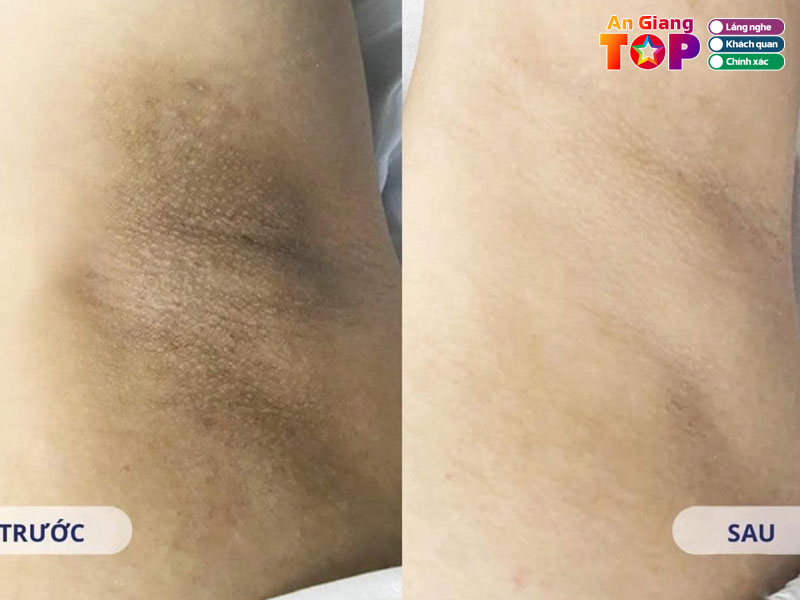 Lanna-spa-long-xuyen-angiangtoplist