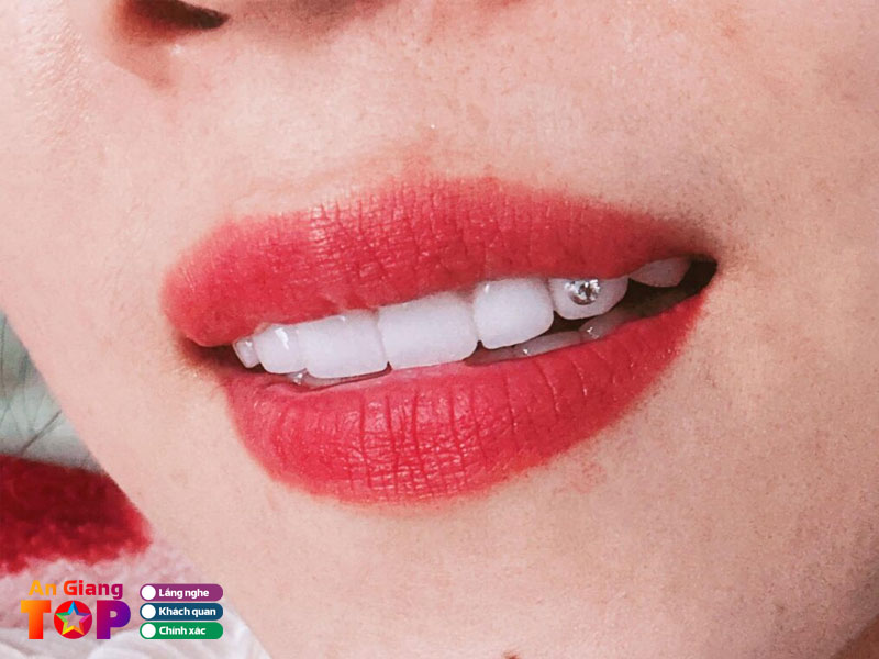 Meo-nho-khi-di-dinh-da-tren-rang-lan-dau-angiangtoplist