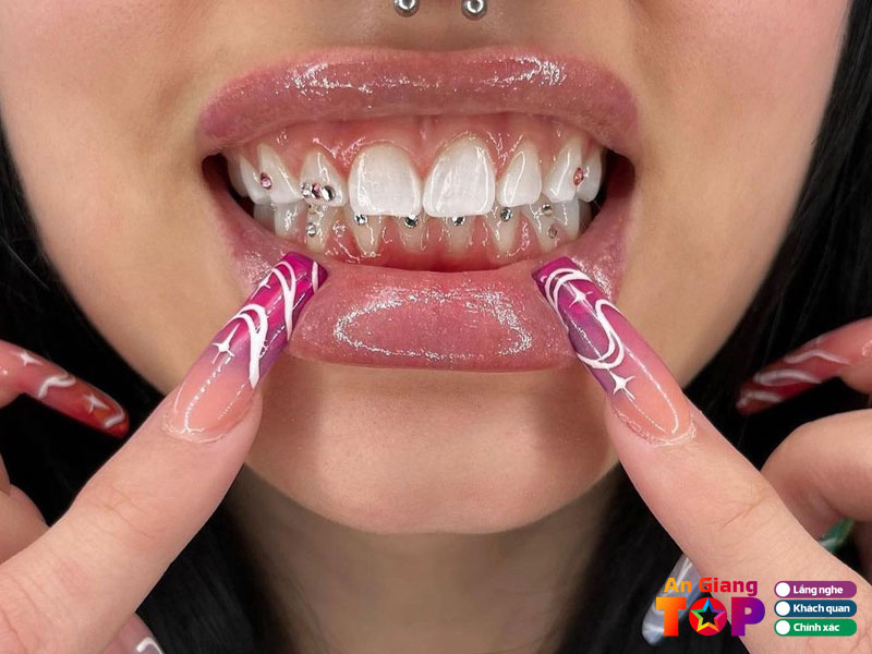 Nha-khoa-quoc-te-1-angiangtoplist