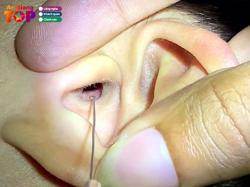 Nhung-luu-y-khi-lay-ray-tai-angiangtoplist