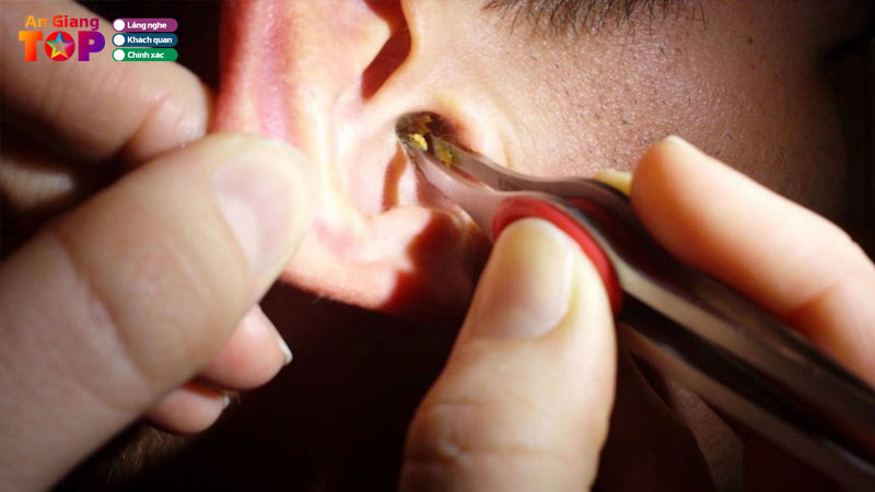 Top-5-dia-chi-lay-ray-tai-o-an-giang-thu-gian-an-toan-angiangtoplist