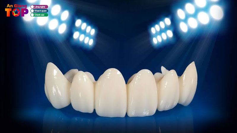 Cau-rang-su-giai-phap-phuc-hinh-rang-nhanh-chong-va-on-dinh-1-angiangtoplist