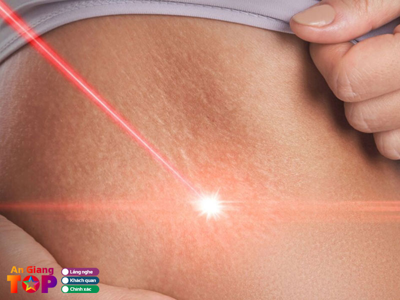 Mot-so-luu-y-truoc-va-sau-khi-dieu-tri-ran-da-angiangtoplist