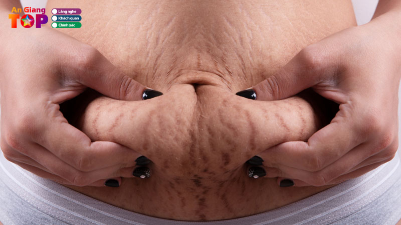 Top-5-dia-chi-dieu-tri-ran-da-o-an-giang-an-toan-hieu-qua-cao-angiangtoplist