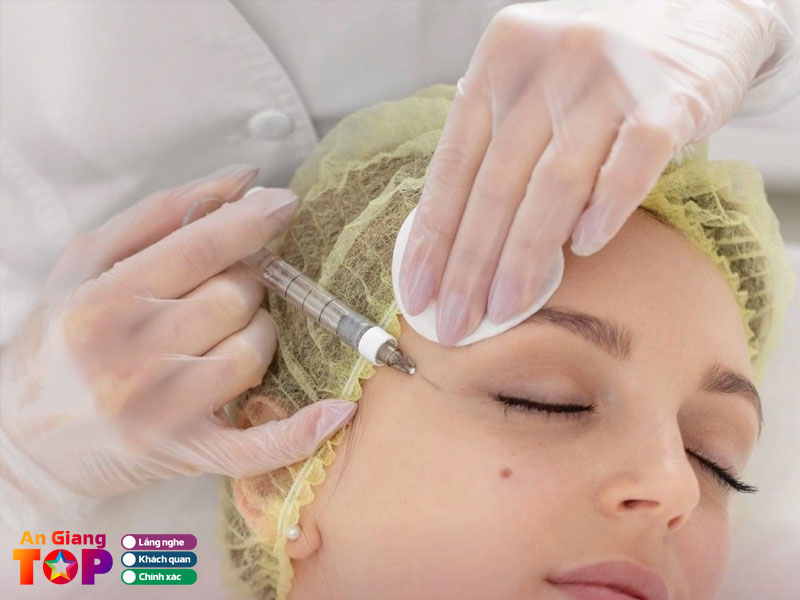 Luu-y-quan-trong-de-duy-tri-hieu-qua-xoa-nhan-lau-dai-angiangtoplist