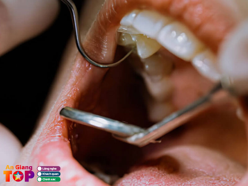 Nha-khoa-long-xuyen-angiangtoplist